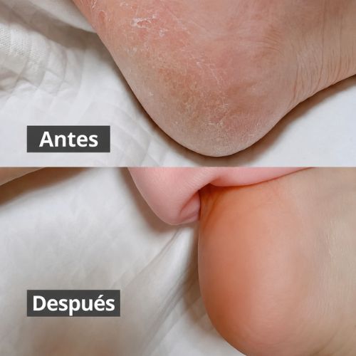 Calcetines Hidratantes de Silicona 2 Unidades